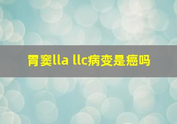 胃窦lla llc病变是癌吗